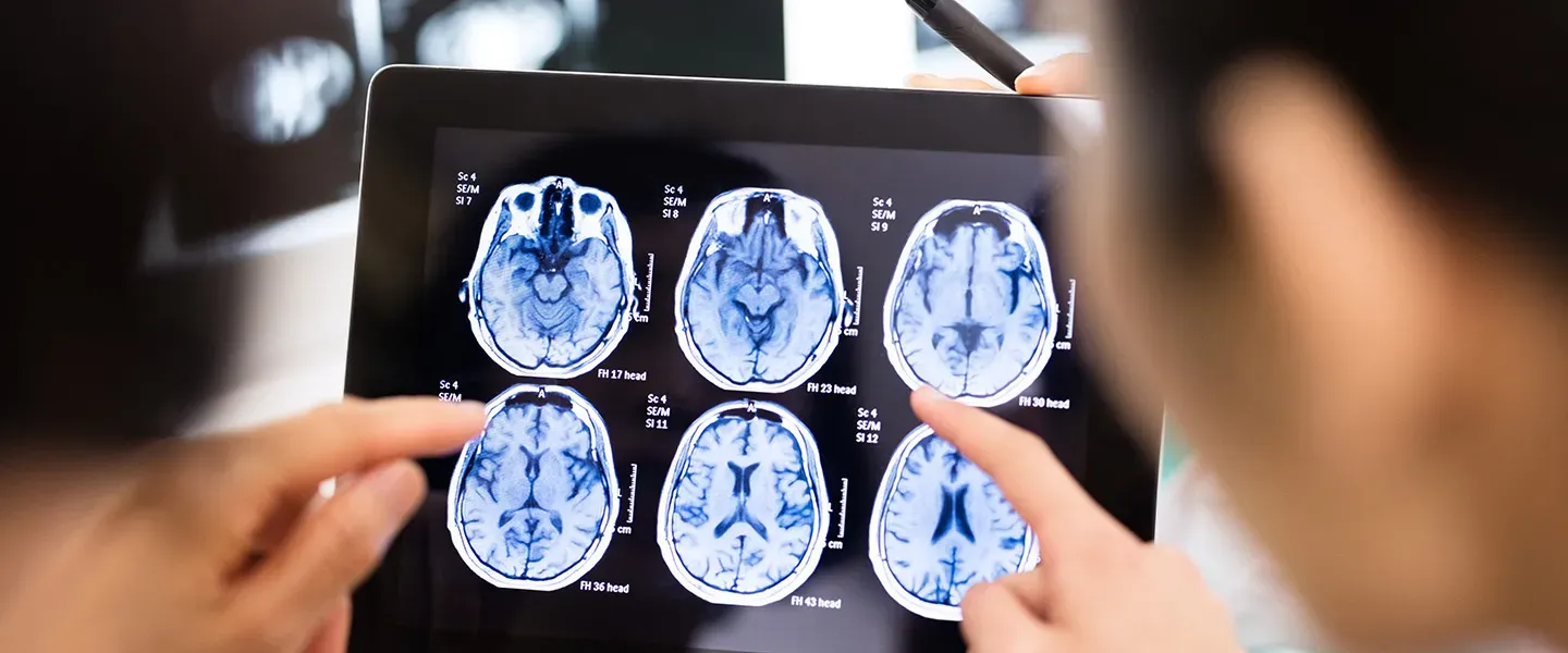 Close up of two people examining an MRI of a skull